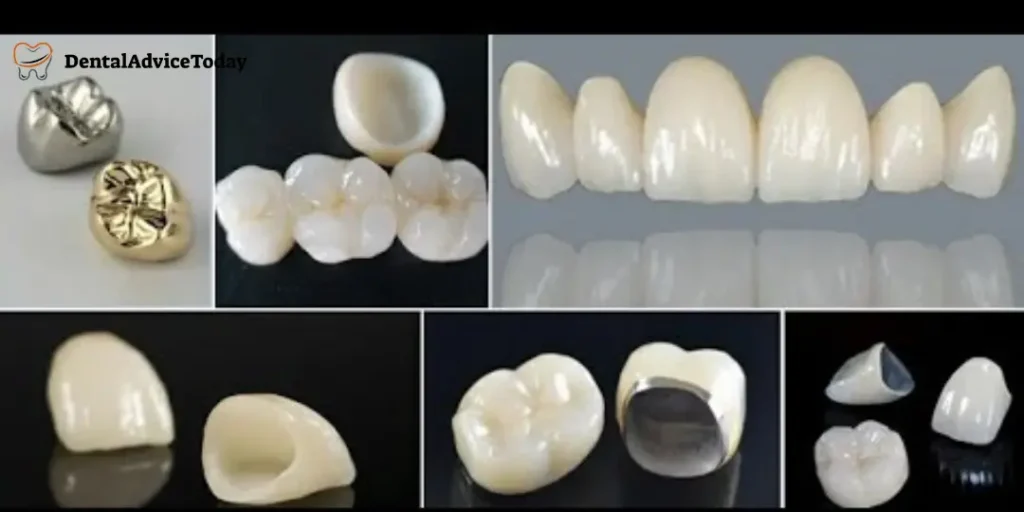 Ceramic Cap For Teeth