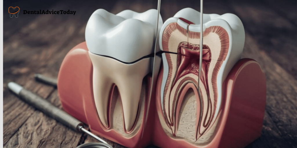 Root Canal Pain Causes, Relief, and Natural Remedies