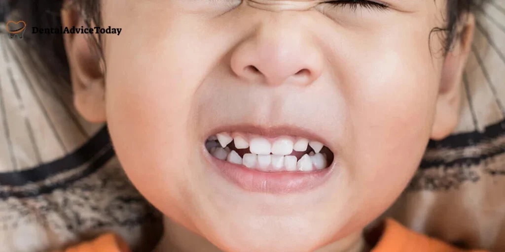 Baby Grinding Teeth Its Causes and Solutions