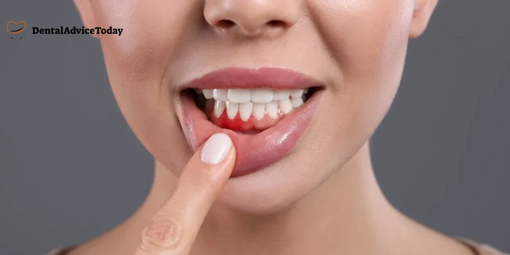 Why Are My Gums Bleeding When I Brush