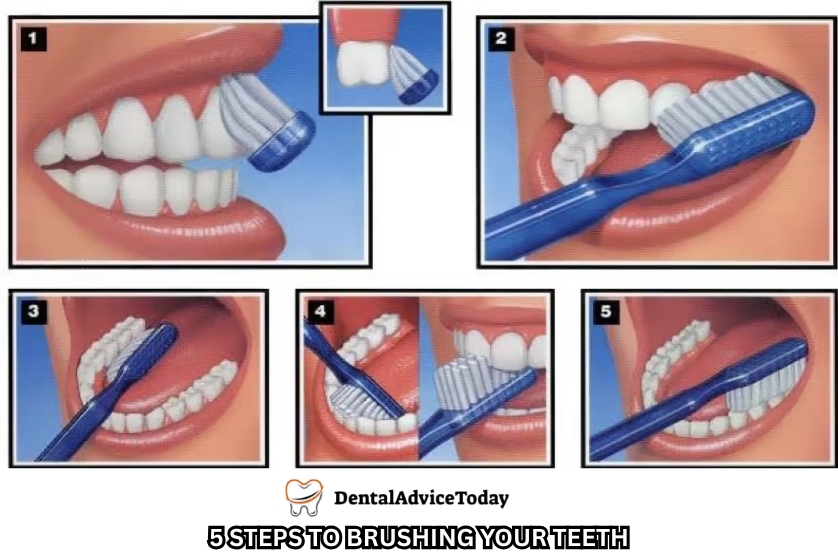 5 Steps to Brushing Your Teeth