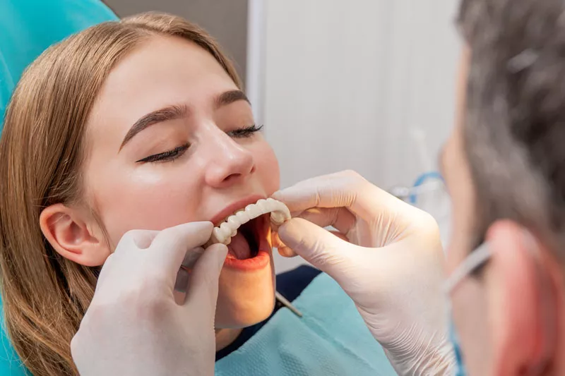 Cost of full mouth dental implants